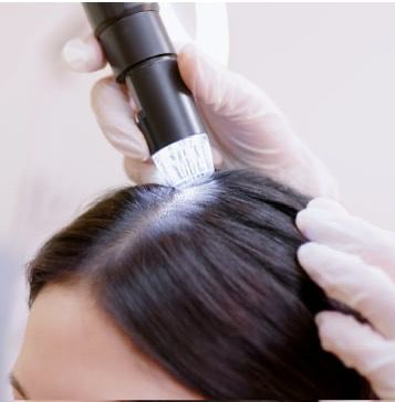 Scalp Treatments